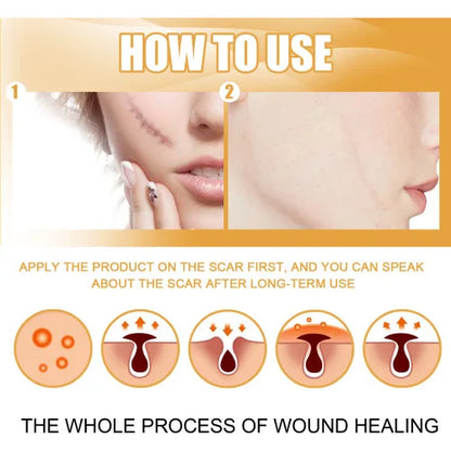 EELHOE Desalting  Skin Burn Scalding Surgical Scar Wound Repair Cream