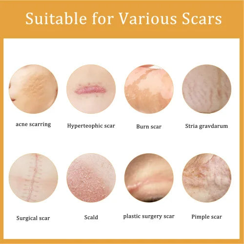 EELHOE Desalting  Skin Burn Scalding Surgical Scar Wound Repair Cream