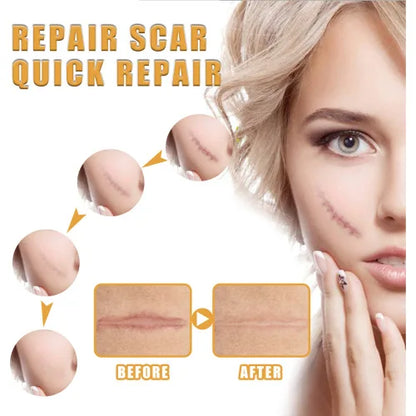 EELHOE Desalting  Skin Burn Scalding Surgical Scar Wound Repair Cream
