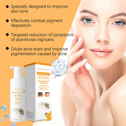 Whitening Facial Cleanser Bee Venom Dark Spot Freckle Removing Deep Cleansing Lightening Skin Tone Moisturizing Face Wash Foam