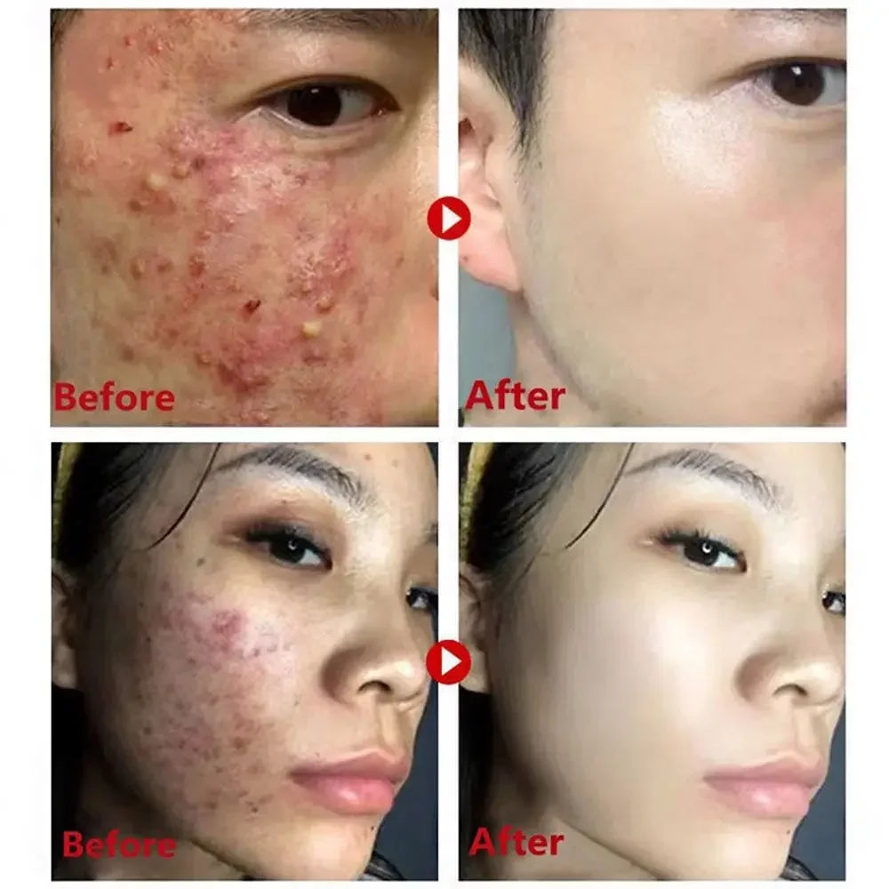 Green Tea Purifying Mask Stick - Deep Cleansing, Oil Control & Moisturizing.