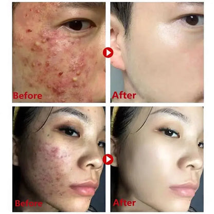 Green Tea Purifying Mask Stick - Deep Cleansing, Oil Control & Moisturizing.