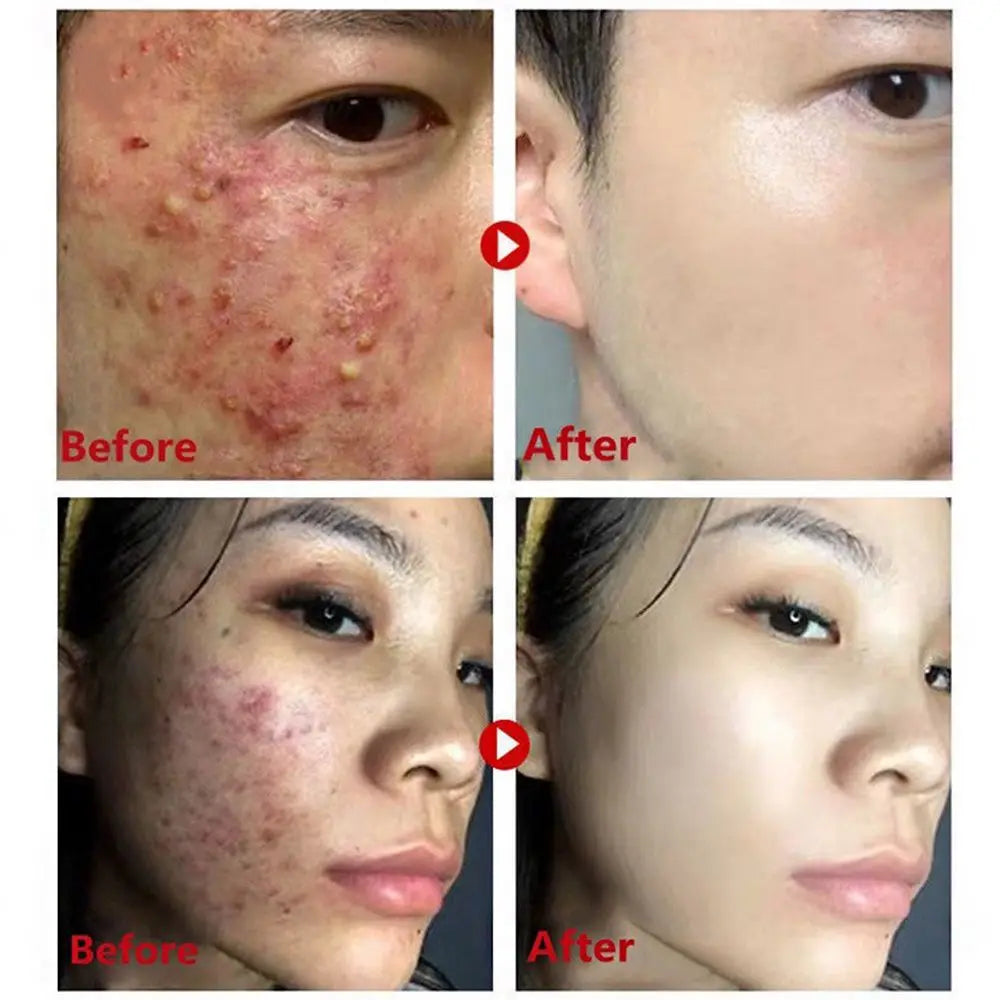 Green Tea Purifying Mask Stick - Deep Cleansing, Oil Control & Moisturizing.