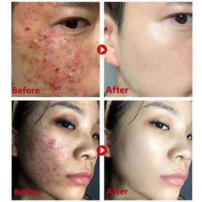 Green Tea Purifying Mask Stick - Deep Cleansing, Oil Control & Moisturizing.