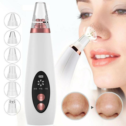 Blackhead Remover Pore Vacuum – Acne Suction Facial Cleanser